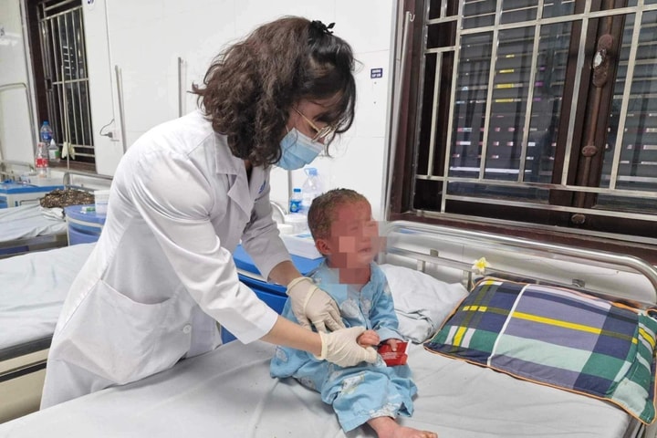 Giải mã “hiệu ứng domino” của bệnh vảy nến