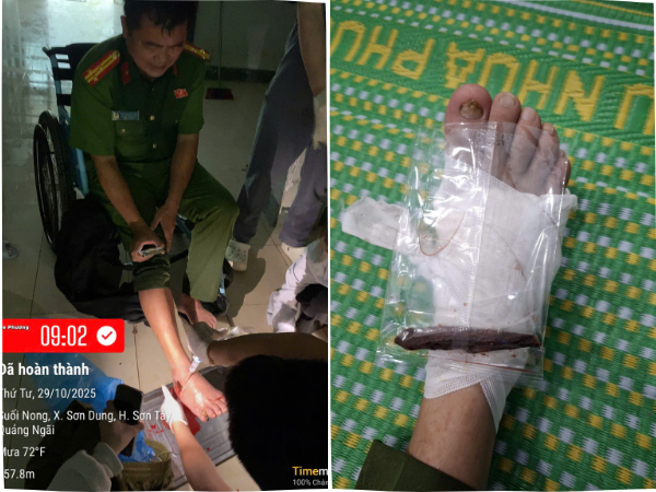 Quảng Ngãi Trưởng Công an xã bị thương nặng khi giúp dân chống lũ