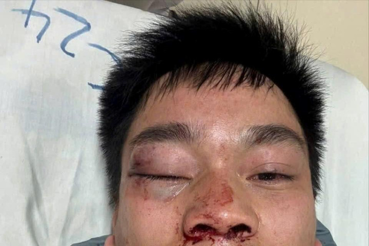 Người đi đường hành hung lái xe buýt số 67 Phùng – Kim Sơn