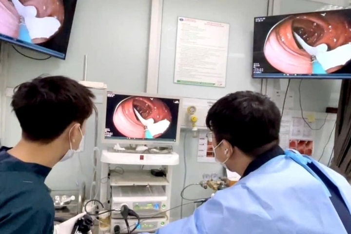 Phát hiện sán dây dài gần 1m trong đại tràng người đàn ông hay ăn đồ tái