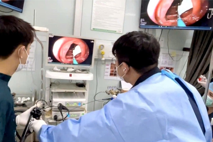 Thường xuyên ăn đồ tái, người đàn ông phát hiện nhiễm sán dây dài gần 80cm trong đại tràng