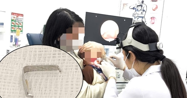 Cấp cứu bé trai bị ghim sắc nhọn mắc trong họng