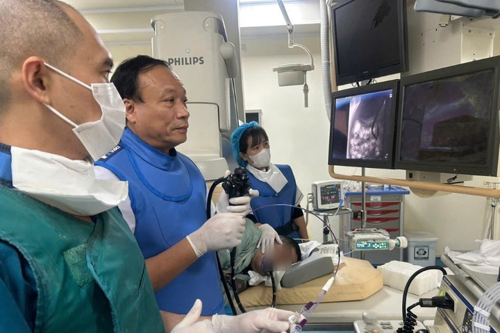 Đau bụng, vàng da tưởng rối loạn tiêu hóa, phát hiện tắc mật nặng do sỏi ống mật chủ