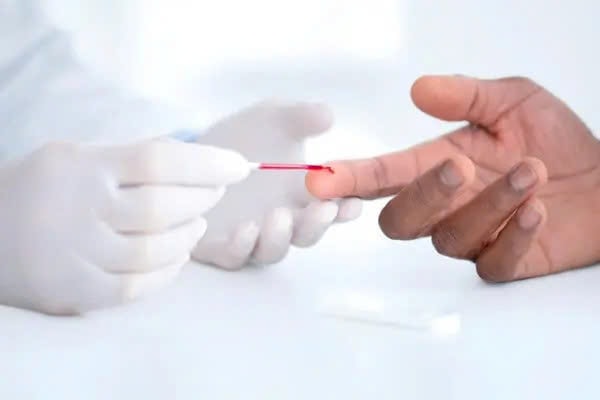 Mỹ khuyến cáo nên tầm soát và điều trị cholesterol từ độ tuổi 30