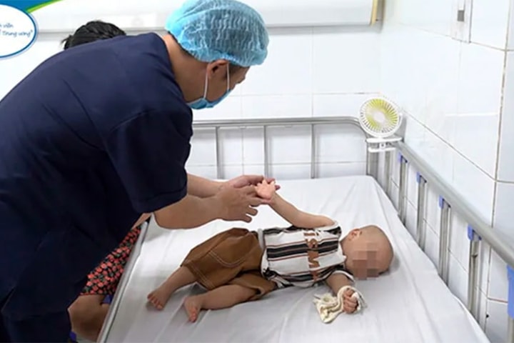 Ghi nhận 25.094 ca mắc bệnh tay chân miệng