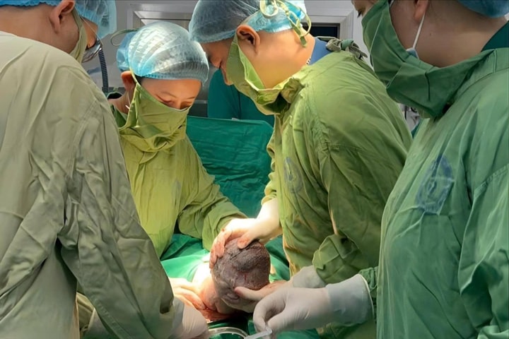 Y học bào thai Việt Nam: Cứu sống hơn 85% thai nhi mắc bệnh lý phức tạp