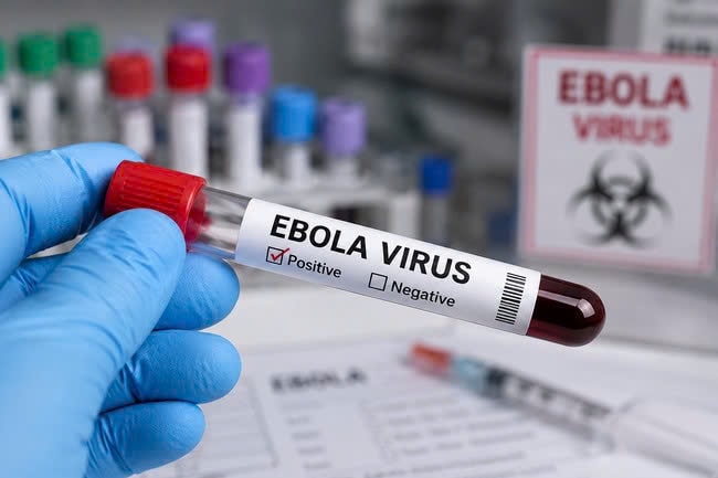 Ngăn chặn từ sớm nguy cơ dịch Ebola xâm nhập qua đường hàng không