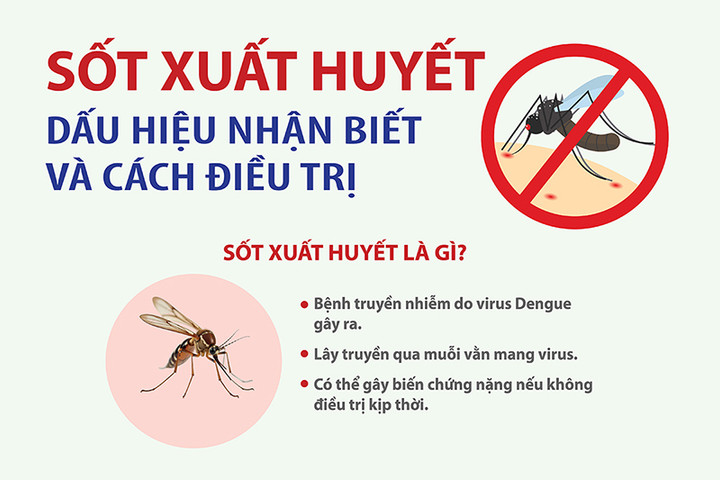Sốt xuất huyết: Dấu hiệu nhận biết và cách điều trị