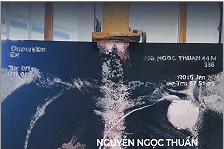 "Vẻ đẹp của kẻ chán chường" - vẻ đẹp của sự sống mong manh